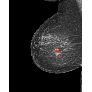 Software diagnostic Mamografie - CAREBOT AI MMG