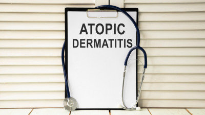 Znate li šta su atopija, ekcem i atopijski dermatitis?