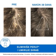 URIAGE DS KERATOREGULIŠUĆI ŠAMPON PROTIV PERUTI 150ML - Img 4