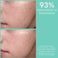 Apivita Just Bee Clear hidratantna matirajuća krema 40 ml - Img 3