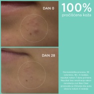 Apivita Just Bee Clear Gel za čišćenje lica 200 ml - Img 6