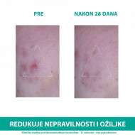URIAGE HYSEAC 3REGUL + 40ml - Img 3