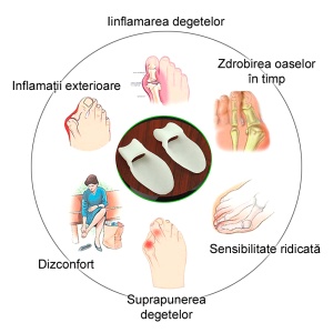 Protecție și Separator Degetul Mare Picioare Set 2 Buc. Unisex