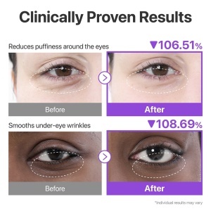 NUMBUZIN No.9 NAD+Collagen Under Eye Patches - Benzi pentru ochi cu colagen marin si niacinamida 5 perechi - Img 7