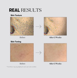 VT COSMETICS - TX Toning - Toner pentru revitalizarea si uniformizarea tenului - 200 ml - Img 4