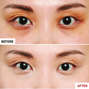 Erborian Super BB Concealer - Anticearcan cu ginseng, SPF25, Dore 10ml - Img 4