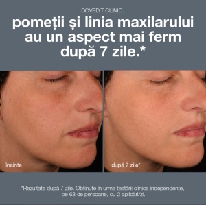 Dermalogica Pro Collagen Boosting Serum - Ser pentru strimularea productiei de colagen 30ml - Img 8