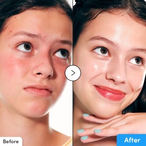 Eqqualberry Hyaluronic Flooding Smoothie Serum - Ser intens hidratant si revitalizant 30ml - Img 6