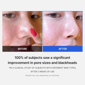 Medicube Zero Pore Pad 2.0 - Dischete faciale pentru pori 70buc/155gr - Img 4