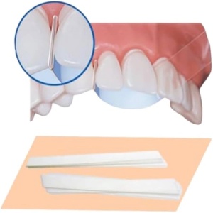 matrici transparente dentare pentru restaurari