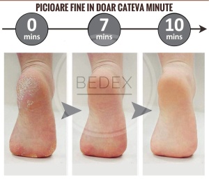 Pila de picioare pentru talpi si calcaie, reincarcabila, rezistenta la apa, fara fir, 2 viteze, 2 capete incluse, culoare roz - Img 4