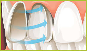 Fatetele dentare