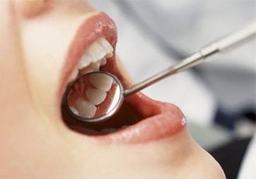 Importanta examinarilor dentare preventive