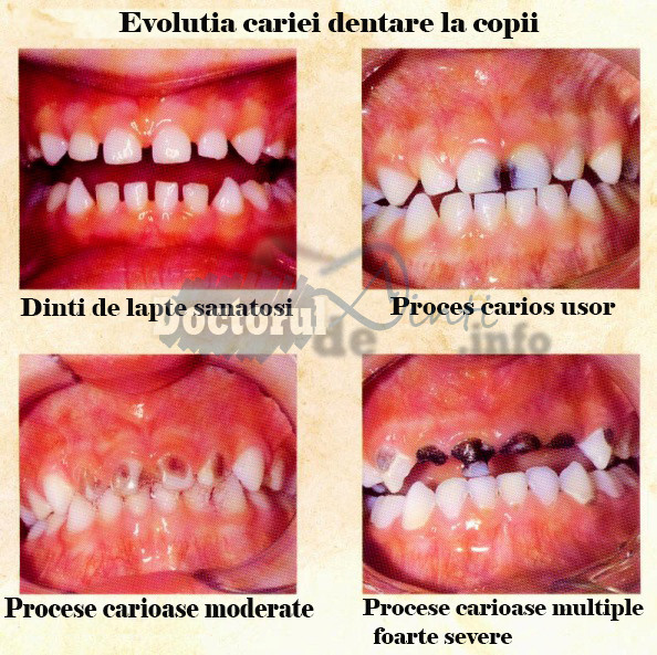 Obiceiuri-proaste-pentru-dintii-copiilor