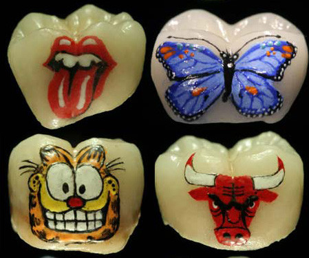 Tatuajul dentar
