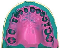 Amprenta in stomatologie
