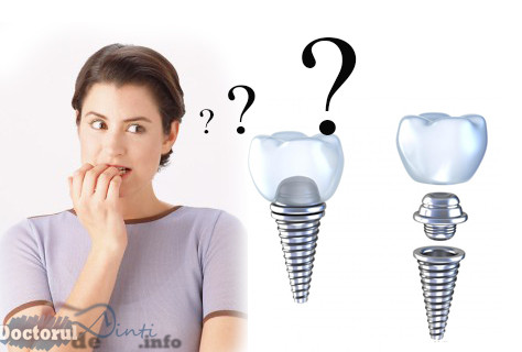 Riscuri implant dentar
