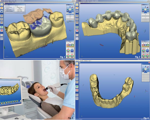 Tehnologia CAD CAM în medicina dentara