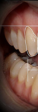 Digital Smile Design