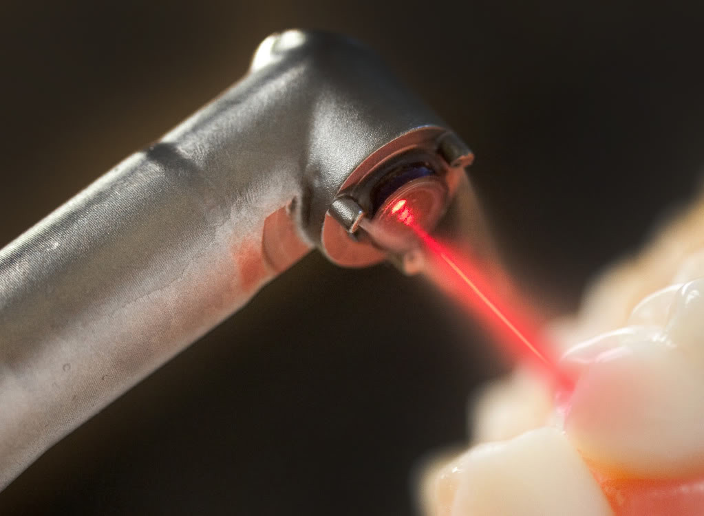 Laserul în stomatologie