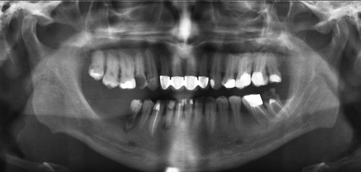 Preț radiografie dentară