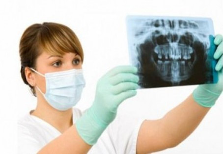 Radiografia dentara - efecte si beneficii