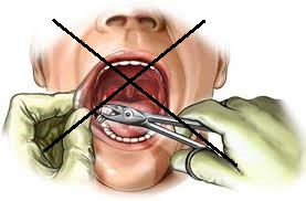 Contraindicatii extractie dentara
