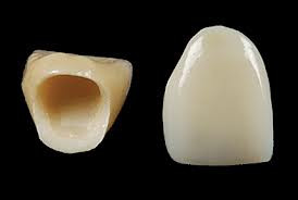 Mase ceramice