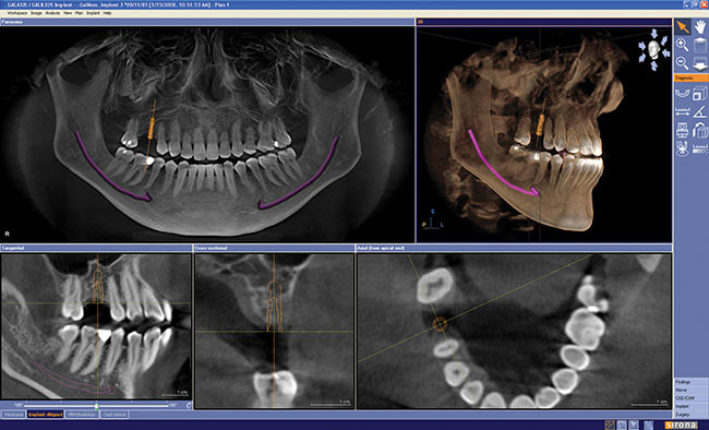 Introducere în imagistica stomatologică - CBCT