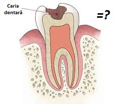 Mecanisme externe in geneza cariilor dentare