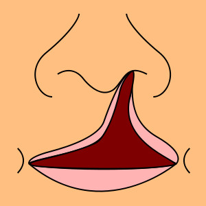 Despicaturile labio-palatine