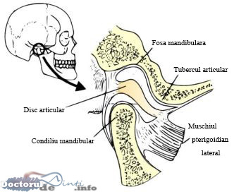 Anchiloza temporo-mandibulara