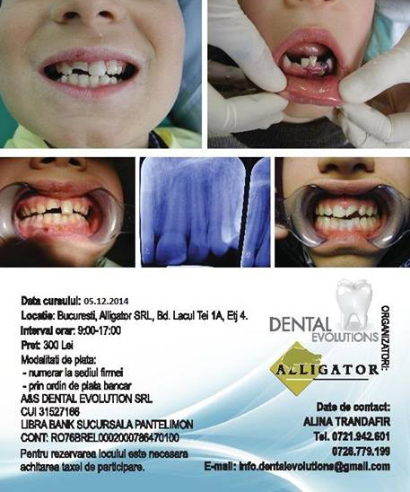 Traumatismele dentare si dentoalveolare la copii si adolescenti