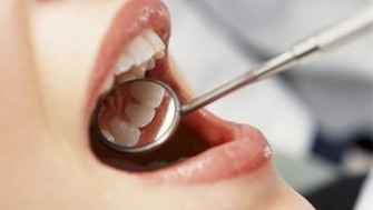 Importanta examinarilor dentare preventive