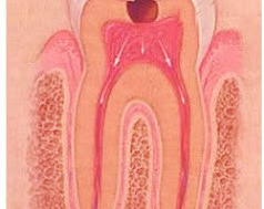 Pulpita dentara