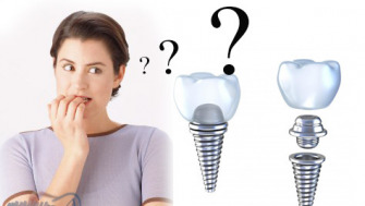 Implantul dentar doare?