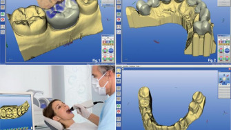 Tehnologia CAD CAM în medicina dentara