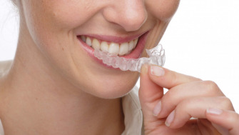 Alternativa aparatelor dentare fixe si mobile - Invisalign