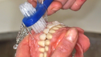 Igienizarea protezei dentare
