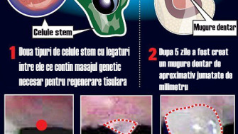 Implant cu mugure dentar - viitorul stomatologiei ?