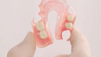 Proteza dentară flexibilă