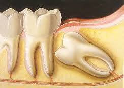 Rezidentiat chirurgie dento alveolara