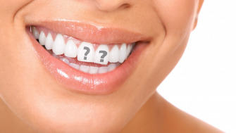Intrebari frecvente despre albirea dentara