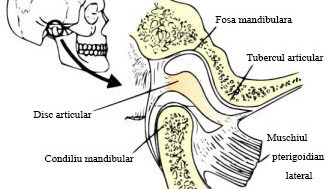 Anchiloza temporo-mandibulara