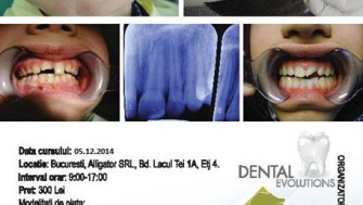 Traumatismele dentare si dentoalveolare la copii si adolescenti