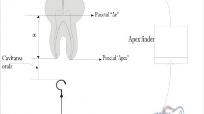 Despre apex finder