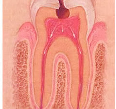 Pulpita dentara