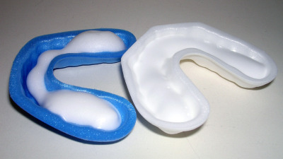 Fluorizarea profesionala