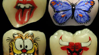 Tatuajul dentar