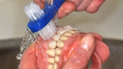 Igienizarea protezei dentare